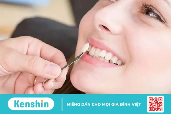 Trồng răng khểnh để tạo nét duyên ngầm đáng yêu