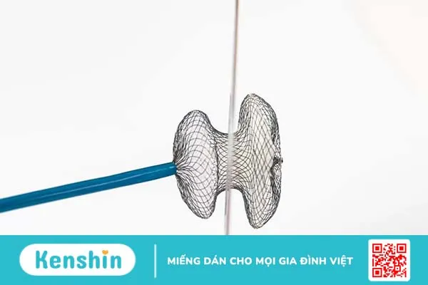 Tứ chứng Fallot và những thông tin toàn diện về bệnh