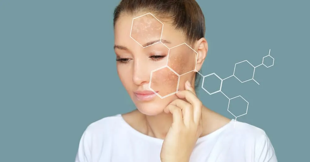 Tuân thủ 7 cách ngăn ngừa nám da để da nhanh trắng sáng trở lại