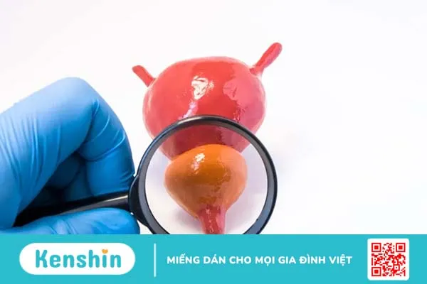 Tuyến tiền liệt nằm ở đâu? Cấu tạo và chức năng ra sao?