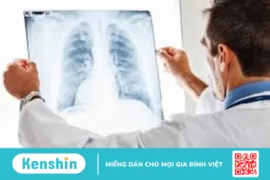 U hạt phổi và những điều bạn cần biết