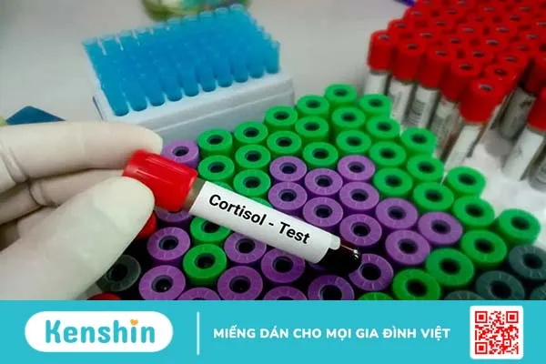 U tuyến yên là gì, có ảnh hưởng gì đến sức khỏe người bệnh?