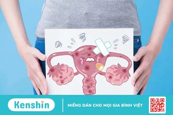 Ung thư buồng trứng giai đoạn đầu: Dấu hiệu, điều trị và tiên lượng