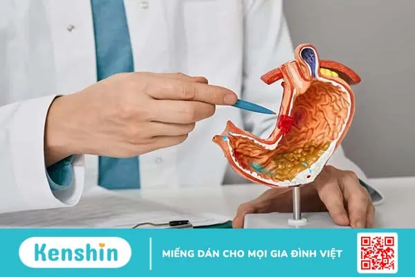 Ung thư dạ dày giai đoạn 2 (II): Điều trị và tiên lượng