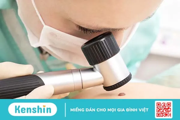 Ung thư da giai đoạn đầu là gì, điều trị như thế nào?