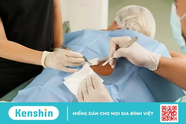 Ung thư da giai đoạn đầu là gì, điều trị như thế nào?