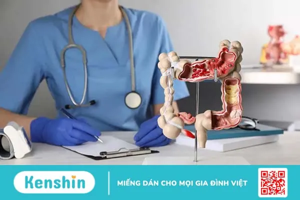 Ung thư đại tràng giai đoạn 1 (I) sống được bao lâu?