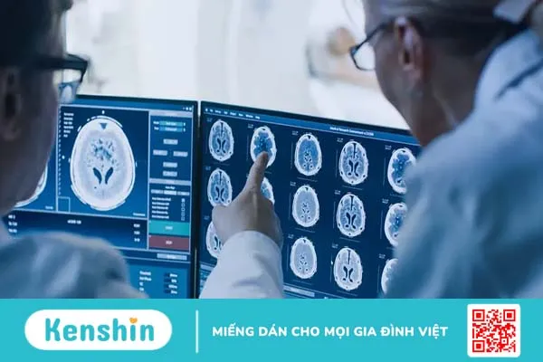 Ung thư di căn não là gì? Điều trị và tiên lượng sống