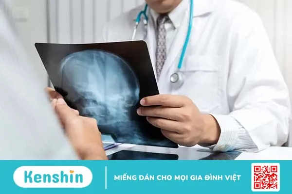 Ung thư di căn não là gì? Điều trị và tiên lượng sống