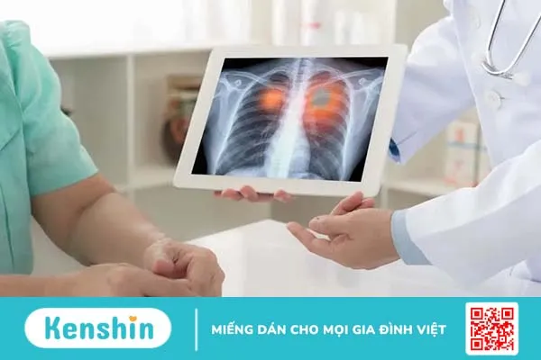 Ung thư phổi giai đoạn cuối: Tiên lượng và điều trị