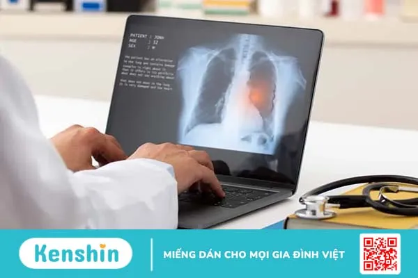 Ung thư phổi giai đoạn đầu sống được bao lâu?