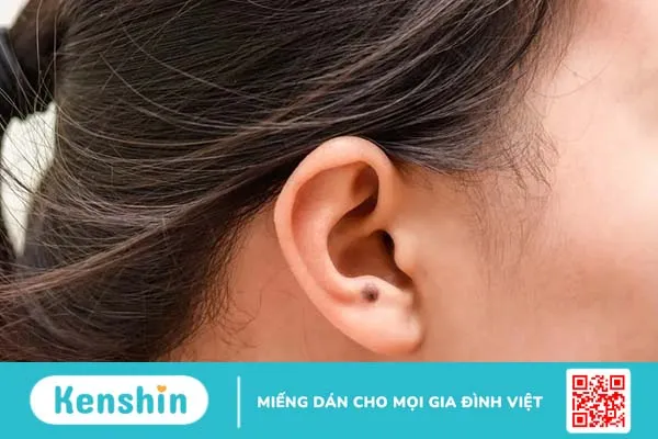 Ung thư tai và những điều có thể bạn chưa biết