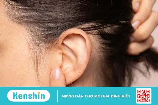 Ung thư tai và những điều có thể bạn chưa biết