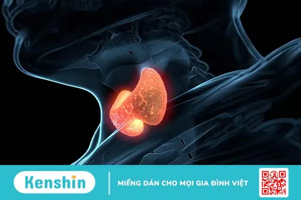 Ung thư tuyến giáp giai đoạn cuối: Dấu hiệu, điều trị và chăm sóc giảm nhẹ