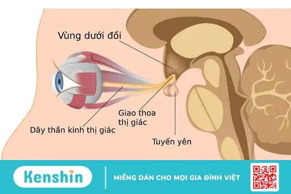 Ung thư tuyến yên Ung thư tuyến yên