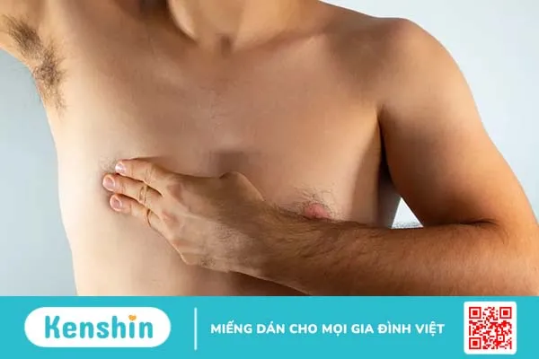 Ung thư vú ở nam giới