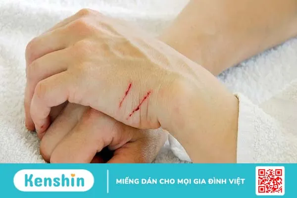 Uốn ván: Nguyên nhân, triệu chứng và cách điều trị – phòng ngừa