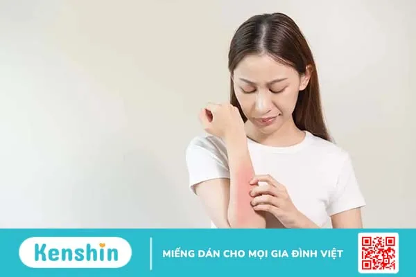 Uống bia bị ngứa, mẩn đỏ là do đâu? Cách khắc phục thế nào?