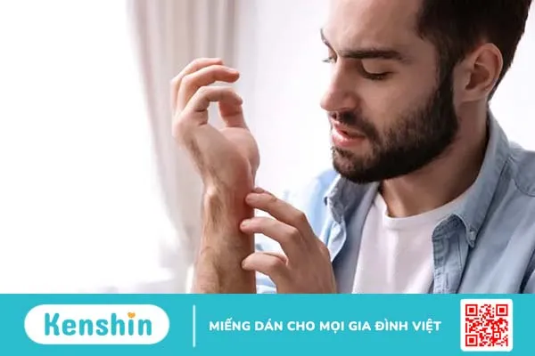 Uống bia bị ngứa, mẩn đỏ là do đâu? Cách khắc phục thế nào?