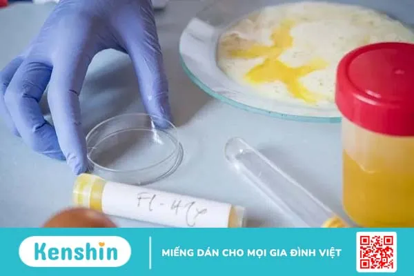 Vấn đề tiêu hóa do nhiễm ký sinh trùng Blastocystis hominis có nguy hiểm không?