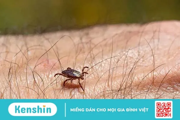 Ve chó cắn người, nguy hiểm khó lường!