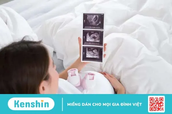 Vẹo cổ ở trẻ sơ sinh: Dấu hiệu và cách điều trị hiệu quả