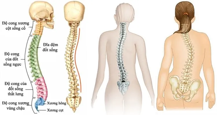 Vẹo cột sống ở trẻ em và nguyên nhân gây đau lưng ở trẻ