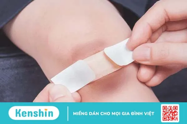 Vết bầm tím