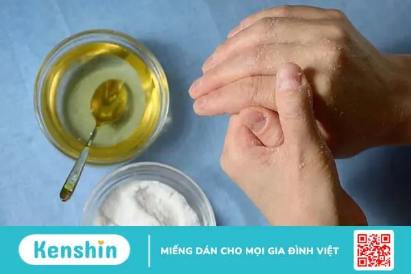 Vết ong đốt bị ngứa phải làm sao? 10 cách làm giảm ngứa khi bị ong đốt