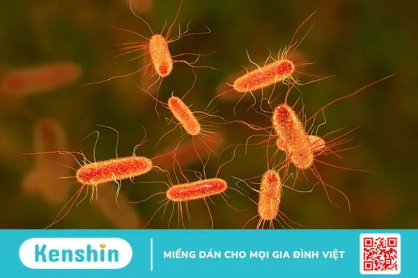 Vi khuẩn E. coli gây bệnh thế nào? Các triệu chứng và cách phòng ngừa