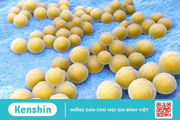 Vi khuẩn tụ cầu vàng nguy hiểm ra sao, gây bệnh gì? Cách nhận biết?