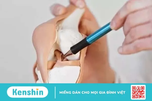 Vì sao đau đầu gối khi chơi thể thao?