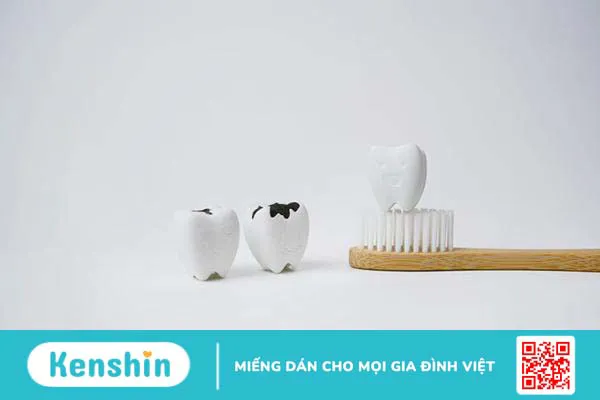 Vì sao răng bé bị đen? 7 nguyên nhân phổ biến khiến bé bị đen răng