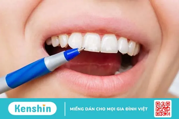 Vì sao răng có đốm trắng? Cách điều trị và ngăn ngừa hiệu quả là gì?