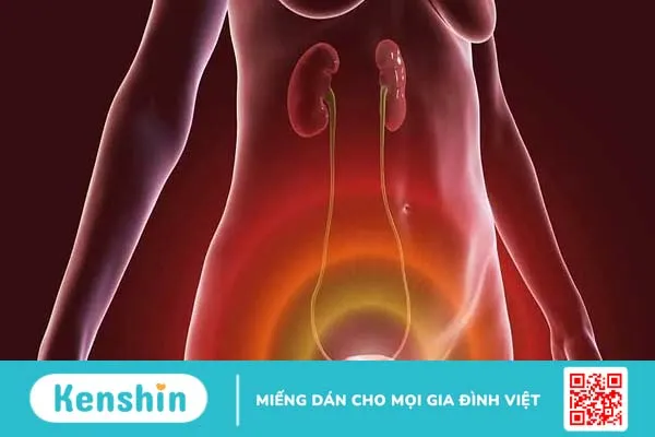 Viêm bàng quang là gì? Nguyên nhân và cách điều trị