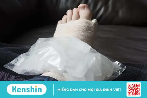 Viêm bao hoạt dịch