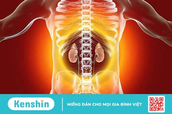 Viêm cầu thận