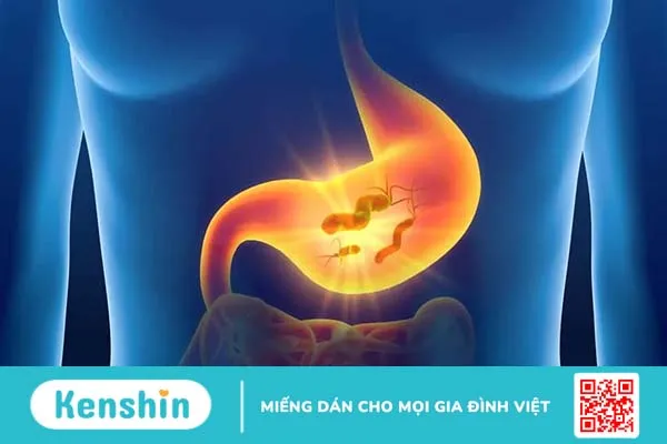 Viêm dạ dày lâu ngày có dẫn đến ung thư không?