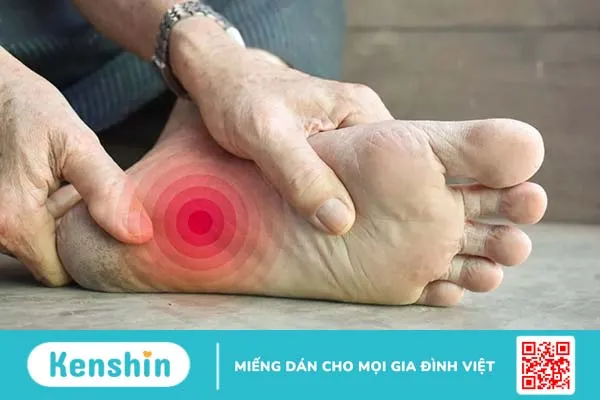 Viêm đa dây thần kinh