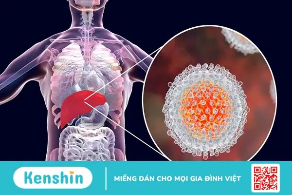 Viêm gan C có lây không? Những con đường lây truyền virus viêm gan C