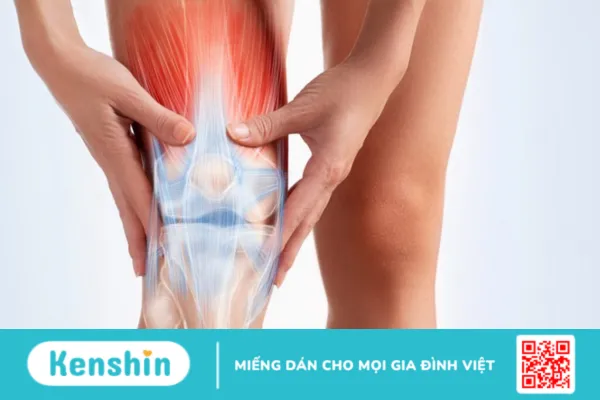 Viêm gân xương bánh chè là bệnh gì ? nguyên nhân và hướng điều trị