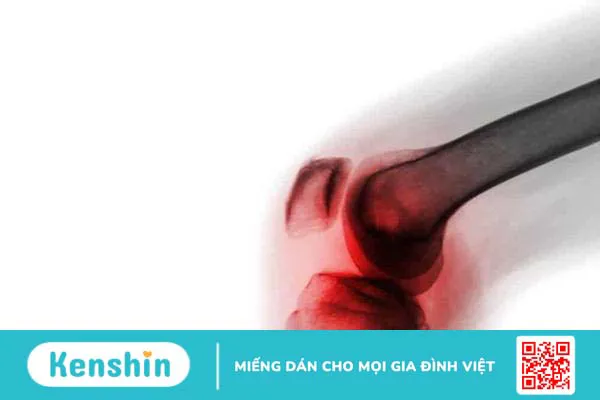 Viêm khớp nhiễm khuẩn