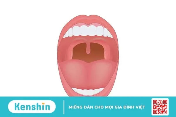 Viêm lưỡi gà: Bạn đã biết rõ triệu chứng, nguyên nhân và cách điều trị?