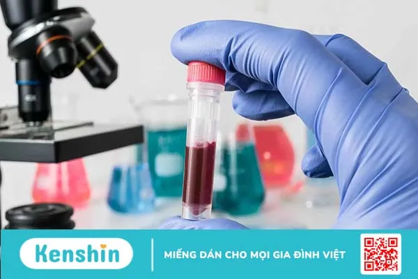 Viêm lưỡi gà: Bạn đã biết rõ triệu chứng, nguyên nhân và cách điều trị?