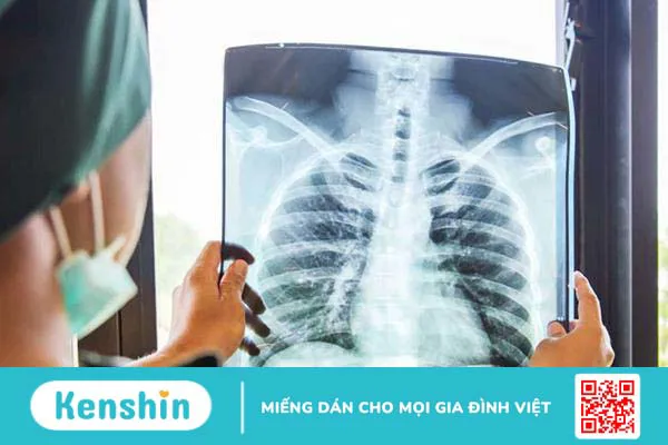 Viêm mủ màng phổi