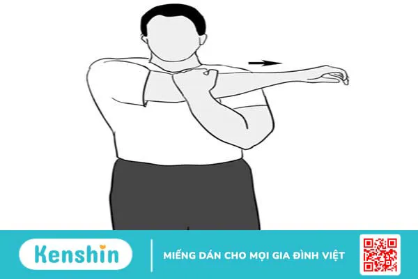 Viêm quanh khớp vai thể đông cứng vai: căn bệnh ít người biết rõ