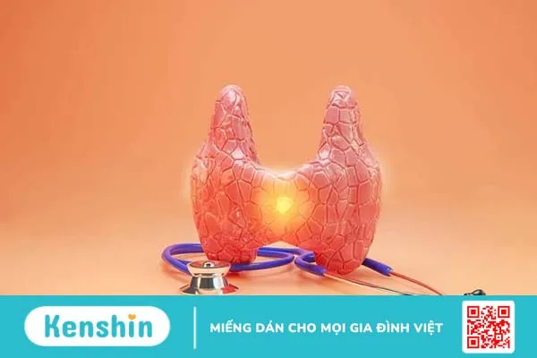 Viêm tuyến giáp bán cấp có nguy hiểm không? Cách điều trị và phòng ngừa thế nào?