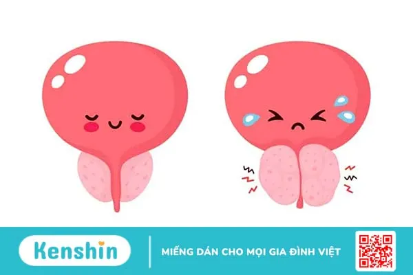 Viêm tuyến tiền liệt