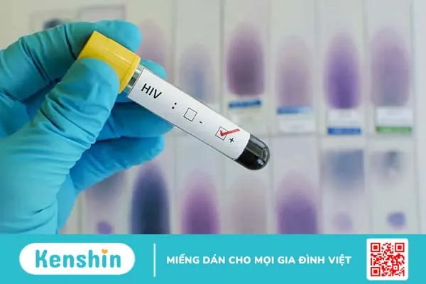 Virus HIV tấn công hệ thống miễn dịch như thế nào?