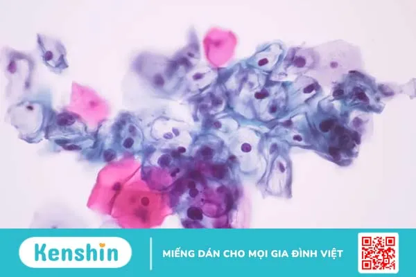 Virus HPV là gì? Tìm hiểu tổng quan về virus HPV